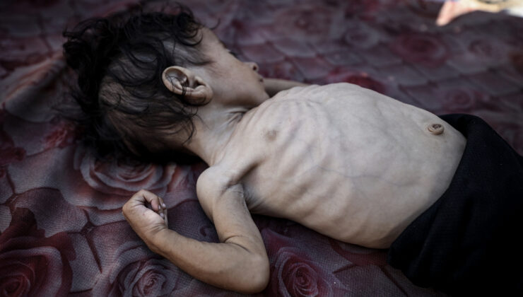 Gazze’de son 24 saatte 5 kişi açlıktan hayatını kaybetti