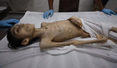 Gazze’de son 24 saatte 7 kişi açlıktan yaşamını yitirdi