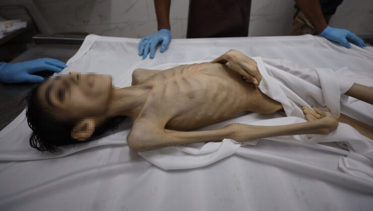 Gazze’de son 24 saatte 7 kişi açlıktan yaşamını yitirdi