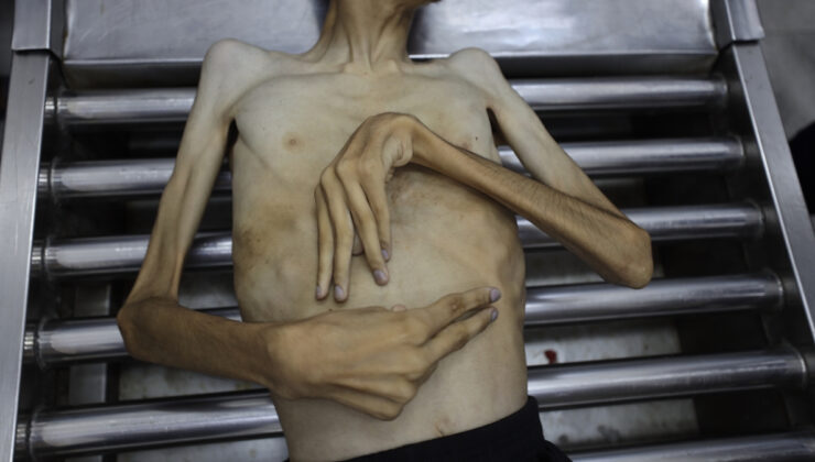 Gazze’de soykırım: 3 Filistinli daha açlıktan öldü