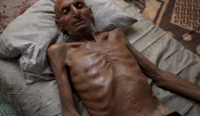 Gazze’de soykırım: 75 yaşındaki adam 40 kiloya düştü