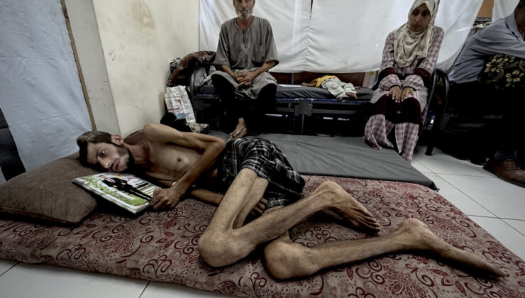 Gazze’de yardım arayışı yaşam mücadelesine dönüştü: İsrail’in saldırısında başından vuruldu