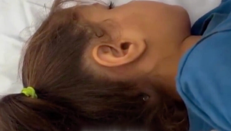 İsrail saldırılarında kafasına mermi saplanan Filistinli kız çocuğu, hayata tutundu