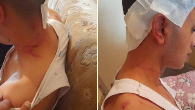 Kamera kayıtları kayıp: MHP’li başkanın oğulları hakkında ‘darp’ iddiası!