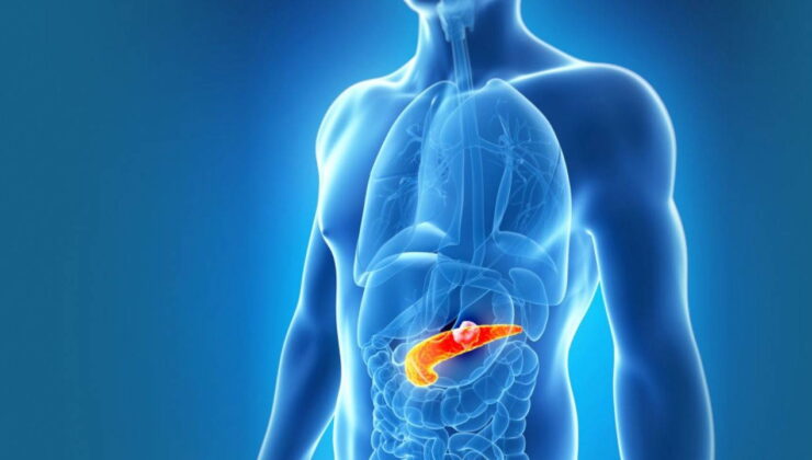 Pankreas kanserinde tedavi umudu: Kanser türlerinde yüzde 62’lik tümor kaybı yaşandı