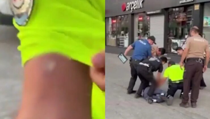 Polisi ısırdı: Serbest bırakıldı