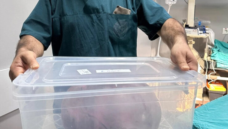 Trabzon’da yumurtalıklarından 9 kiloluk kitle çıktı