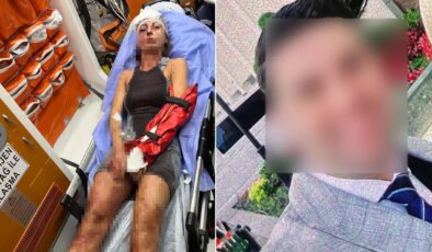 Uzaklaştırma kararı aldıran kadına dehşeti yaşattı: Sopayla darbetti, ellerini kırdı!