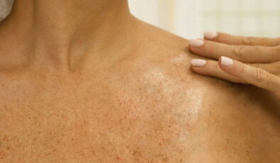 Uzmanı uyardı: Mantarlar yaz aylarında tehdit oluşturuyor!