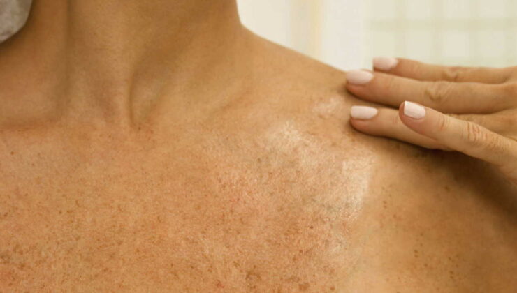 Uzmanı uyardı: Mantarlar yaz aylarında tehdit oluşturuyor!