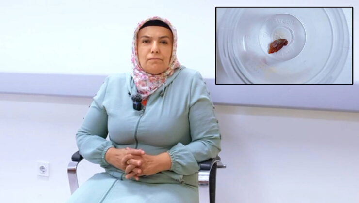 1,5 yıllık öksürüğün nedeni, kabak çekirdeği çıktı