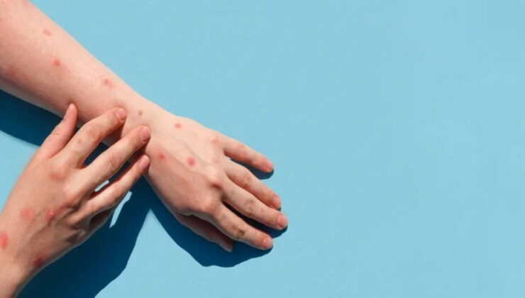 Bangladeş’te dang humması nedeniyle son 24 saatte 3 kişi öldü