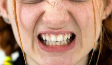 Dişlerinizi sıkmayın: Migrene neden oluyor