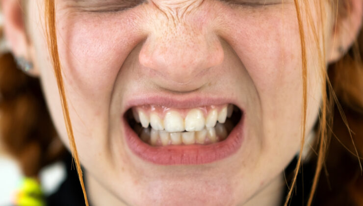 Dişlerinizi sıkmayın: Migrene neden oluyor