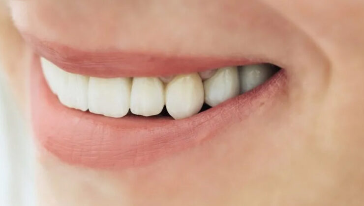 Dişlerinizin rengine dikkat: Meğer o hastalığın habercisiymiş