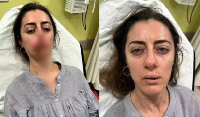 Eşinin sevgilisi sanıp darbetti: Otomobil kapısı, ‘silah’ sayıldı!