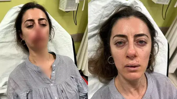 Eşinin sevgilisi sanıp darbetti: Otomobil kapısı, ‘silah’ sayıldı!