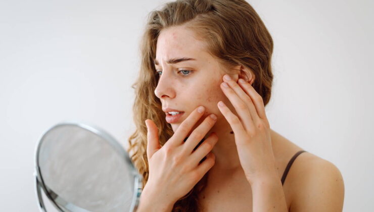 Evinizde hazırlayacağınız pratik çözümlerle sağlıklı ve parlak bir cilde kavuşun: Cilt lekelerine karşı etkili 7 doğal kür