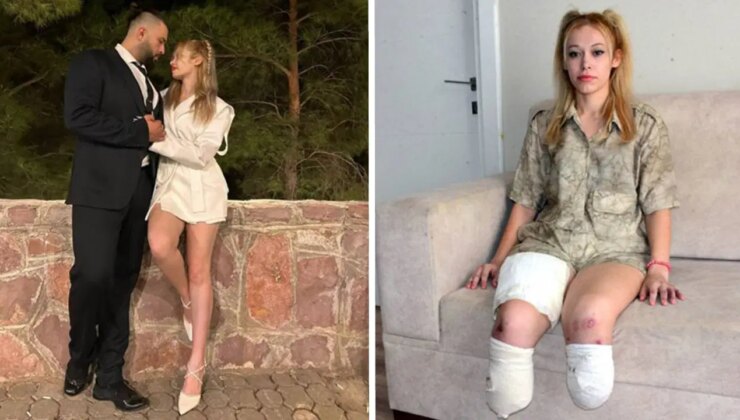 Evlilik yıl dönümü faciayla bitti: Genç fitness eğitmeni iki bacağını kaybetti