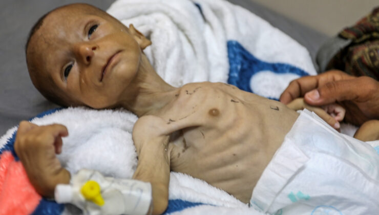 Gazze ‘felaketi’ yaşıyor: 2 aylık bebeğin yaşamı tehdit altında