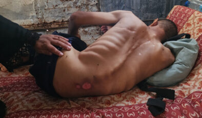 Gazze’de 6 kişi daha açlıktan hayatını kaybetti