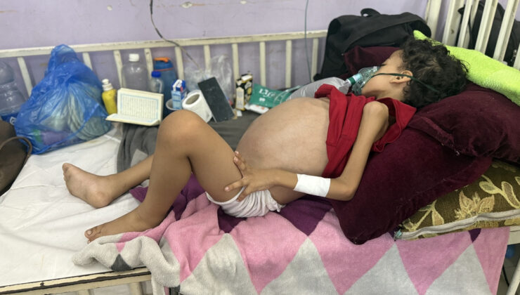 Gazze’de 6 yaşındaki Zeyn, ağır sağlık sorunlarıyla mücadele ediyor