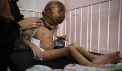 Gazze’de acı tablo: 7 yaşındaki Mey, sağlık sorunlarıyla mücadele ediyor