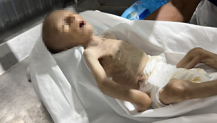 Gazze’de bir bebek daha açlıktan öldü