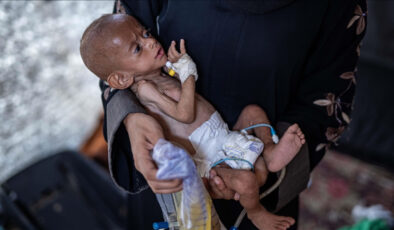 Gazze’de kıtlık: Yetersiz beslenme sonucu can kaybı 453’e yükseldi