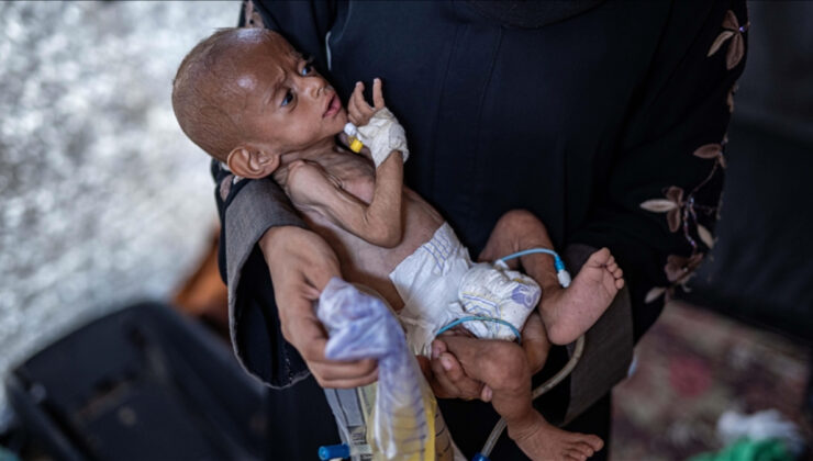 Gazze’de kıtlık: Yetersiz beslenme sonucu can kaybı 453’e yükseldi