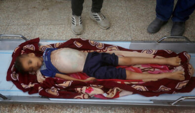 Gazze’de soykırım: 8 yaşındaki çocuk açlıktan hayatını kaybetti