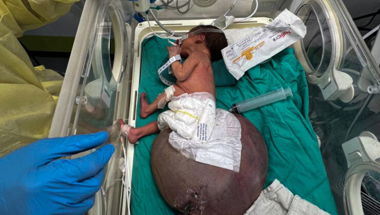 Gazze’de tıbbi malzeme krizi: Bebek Tülin, İsrail abulkasının pençesinde