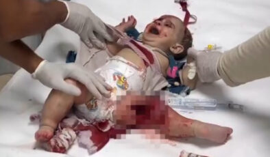 İsrail, Gazze’de bebekleri hedef alıyor