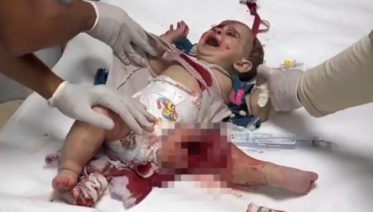 İsrail, Gazze’de bebekleri hedef alıyor