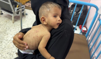 İsrail’in açlık politikasının yeni kurbanı: Ali