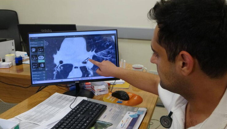 Malatya’da şoke eden olay: Kansersin denilen hastanın akciğerinden çekirdek çıktı!