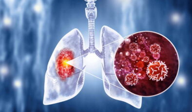 ’50 yaşını aşan sigara içicileri yılda bir taramadan geçmeli’ uyarısı