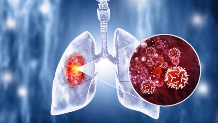 ’50 yaşını aşan sigara içicileri yılda bir taramadan geçmeli’ uyarısı