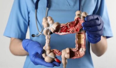 Bu alışkanlıklar kolon kanseri riskini katlıyor!