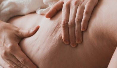 Cildinizi sıkılaştırın: Selülitle savaşan besinler