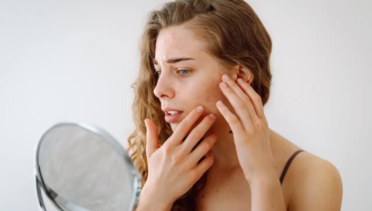 Cilt hastalıklarına neden oluyor, tahrişe yol açıyor: Cilt bakımında uzak durulması gereken 10 ürün