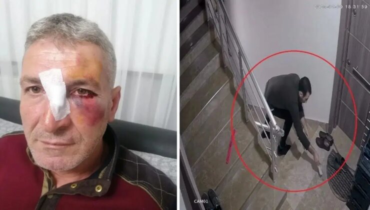 Dairesinin önüne hayvan dışkısı atan komşusundan, bu kez ‘yüzüne kapı çarptığı’ gerekçesiyle şikayetçi oldu