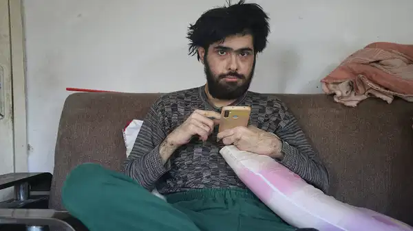 Depremden sonra kendini eve kapattı… Telefon bağımlısı genç ne duş alıyor ne de tırnaklarını kesiyor! ‘Elimde olsa tuvalete gitmem’