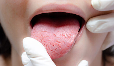 Dil vücudun aynası: Bu değişimlere dikkat