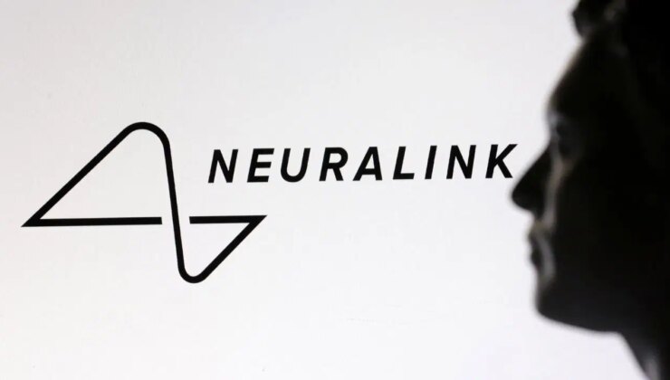 Elon Musk’ın beyin çipi projesi için 10 bin kişi sırada bekliyor
