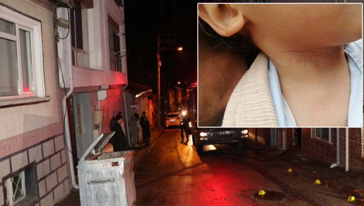 Eskişehir’de kan donduran olay: 1,5 yaşındaki çocuğun boynunu kesti, evini yakmaya kalktı!