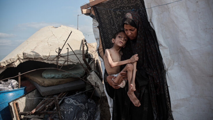 Gazze’de açlıktan ölenlerin sayısı 457’ye yükseldi