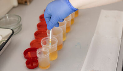 İdrarda bu detaya dikkat: Sağlıkla ilgili mesaj veriyor