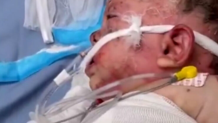 İsrail zulmünün utanç karesi: Gazze’de 10 aylık bebek ağır yaralandı