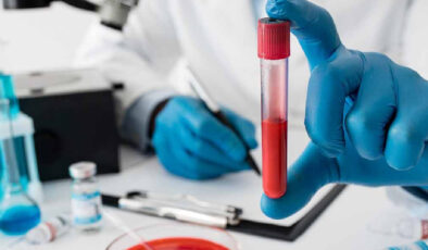 Kansızlığı anlamanın 7 sinyali: Bu belirtiler varsa dikkat